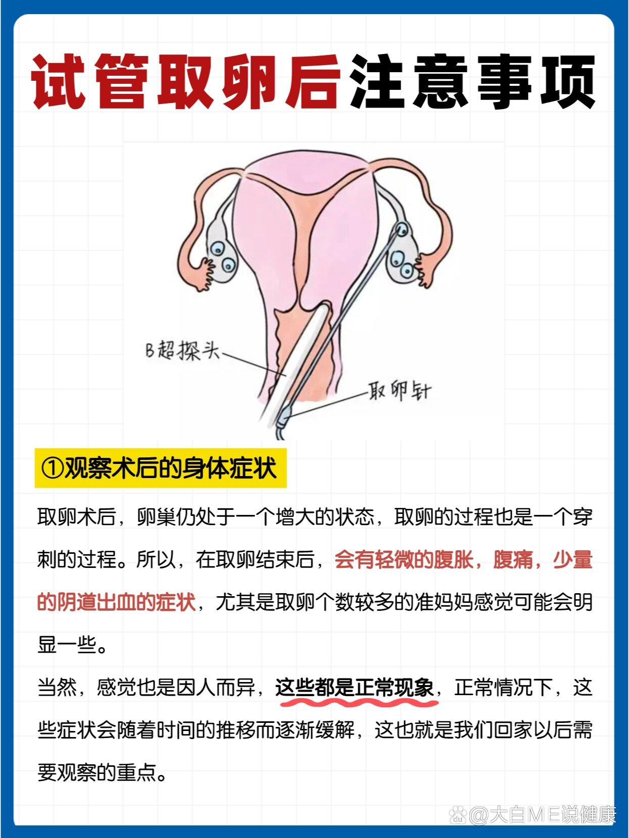 取卵疼吗图片