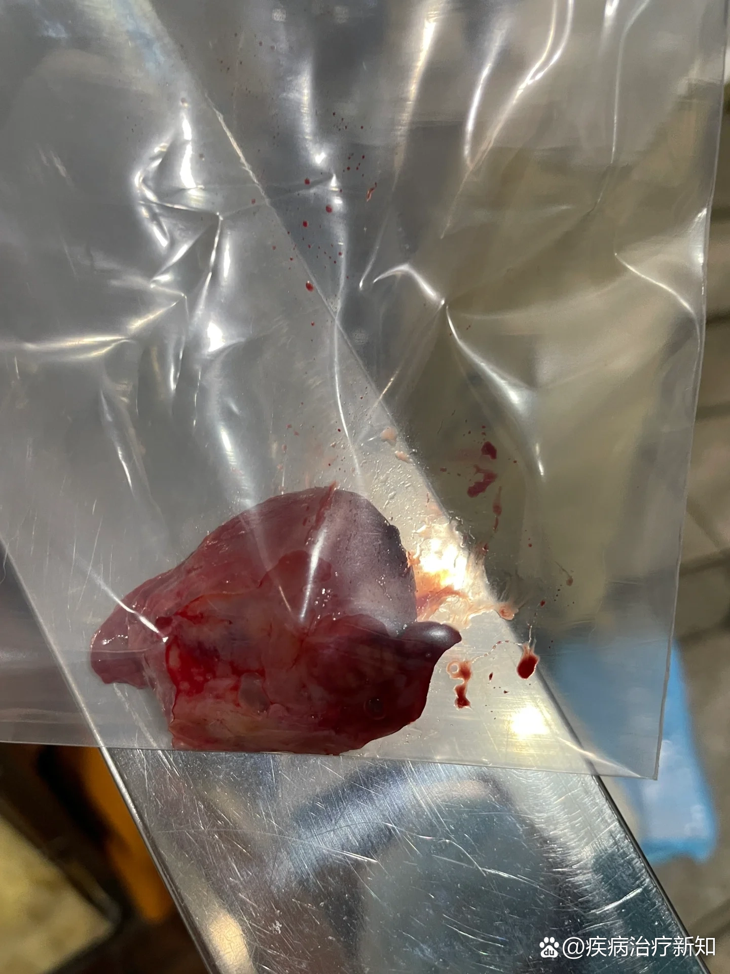 狗狗唾液腺囊肿