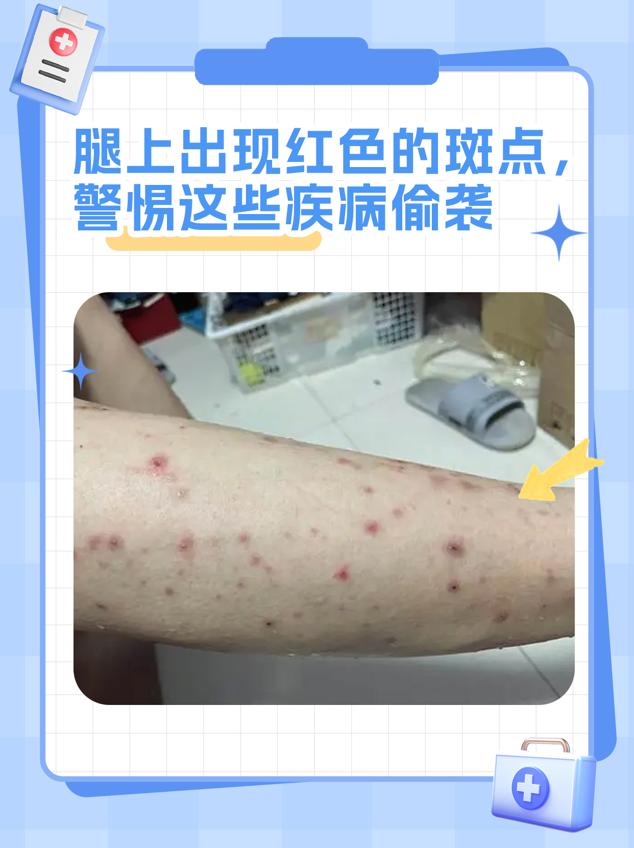 "给她进行了皮肤视诊,腿上的确有一些明显的红色斑点,大小不