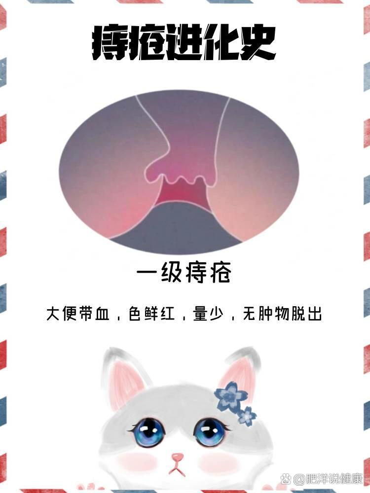 痔疮出血量大图片