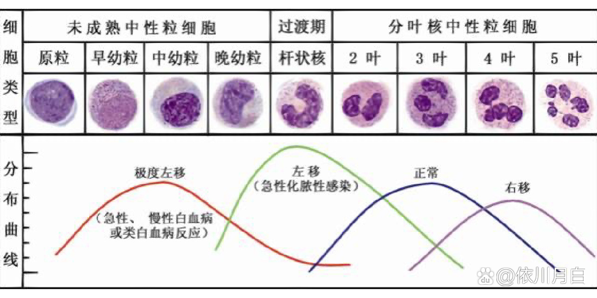 外周血异常白细胞形态
