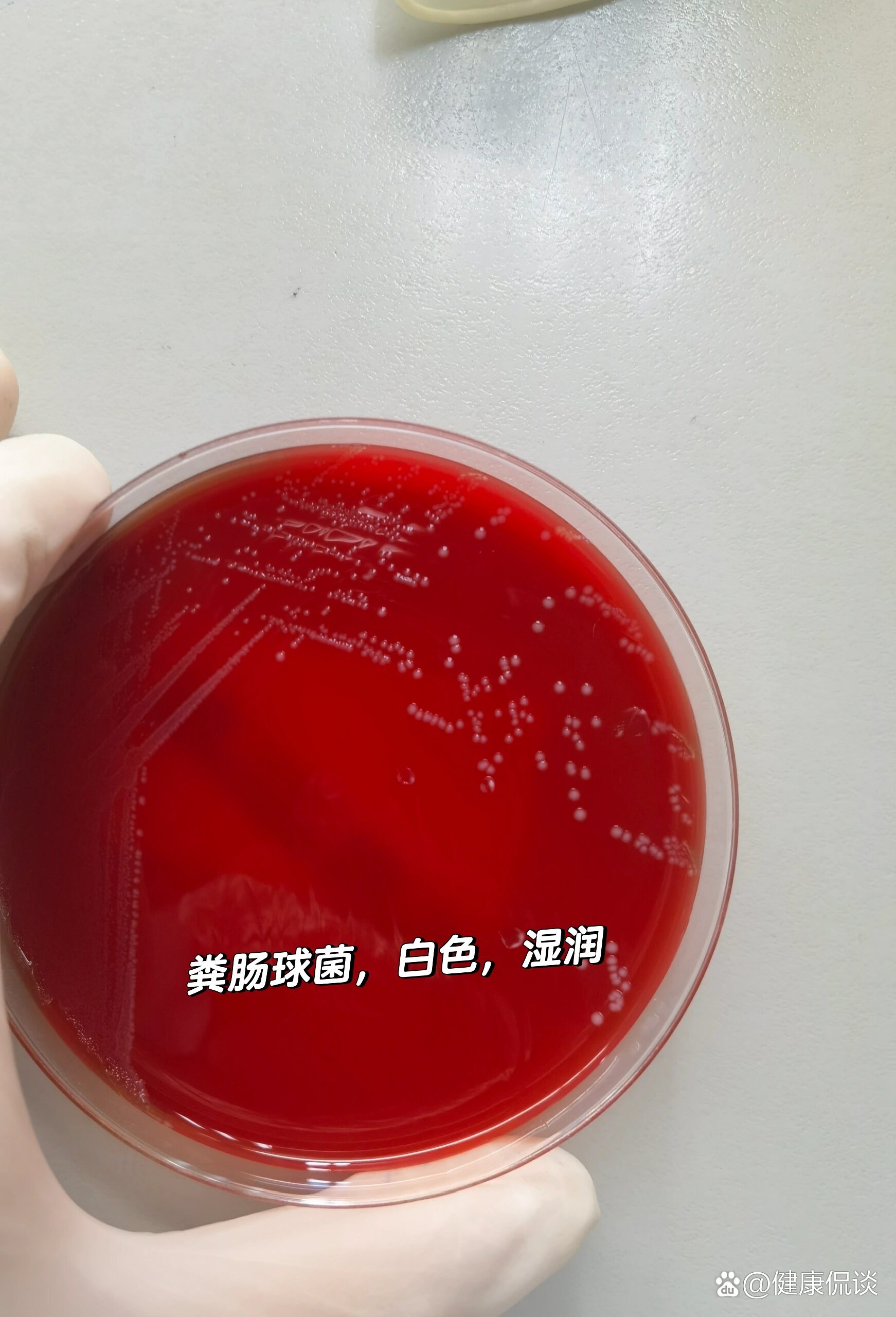 屎肠球菌 全网资源