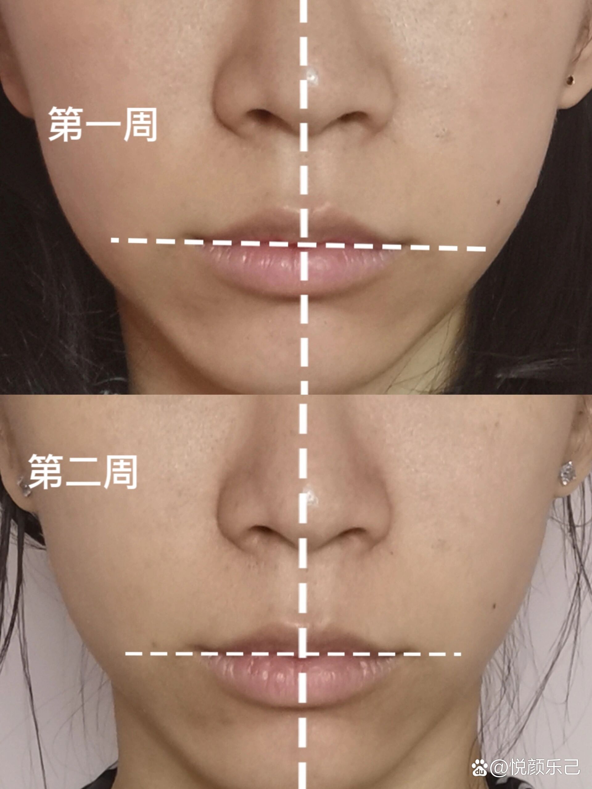 脸歪自我矫正打卡第二周