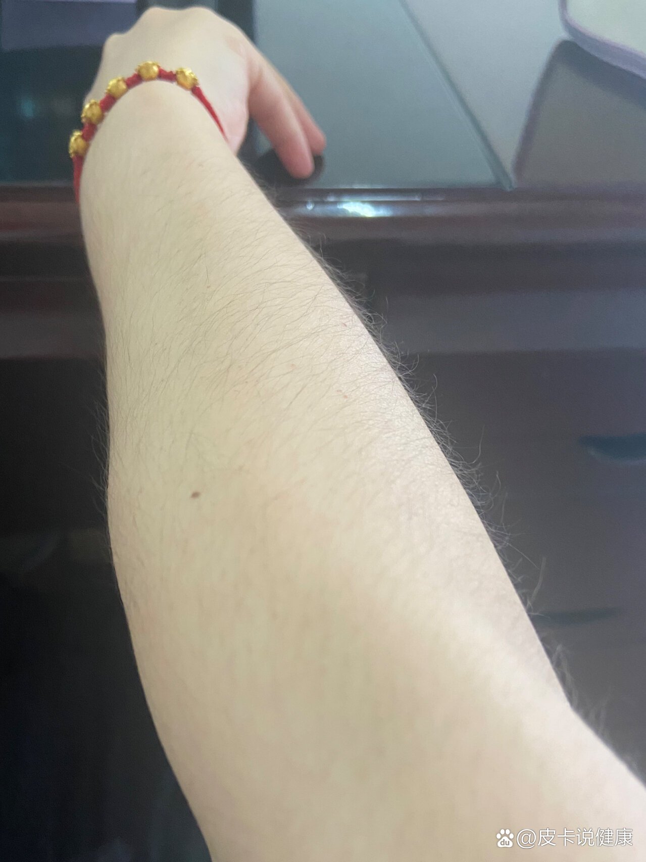 拿什么来拯救我这个手臂上的毛