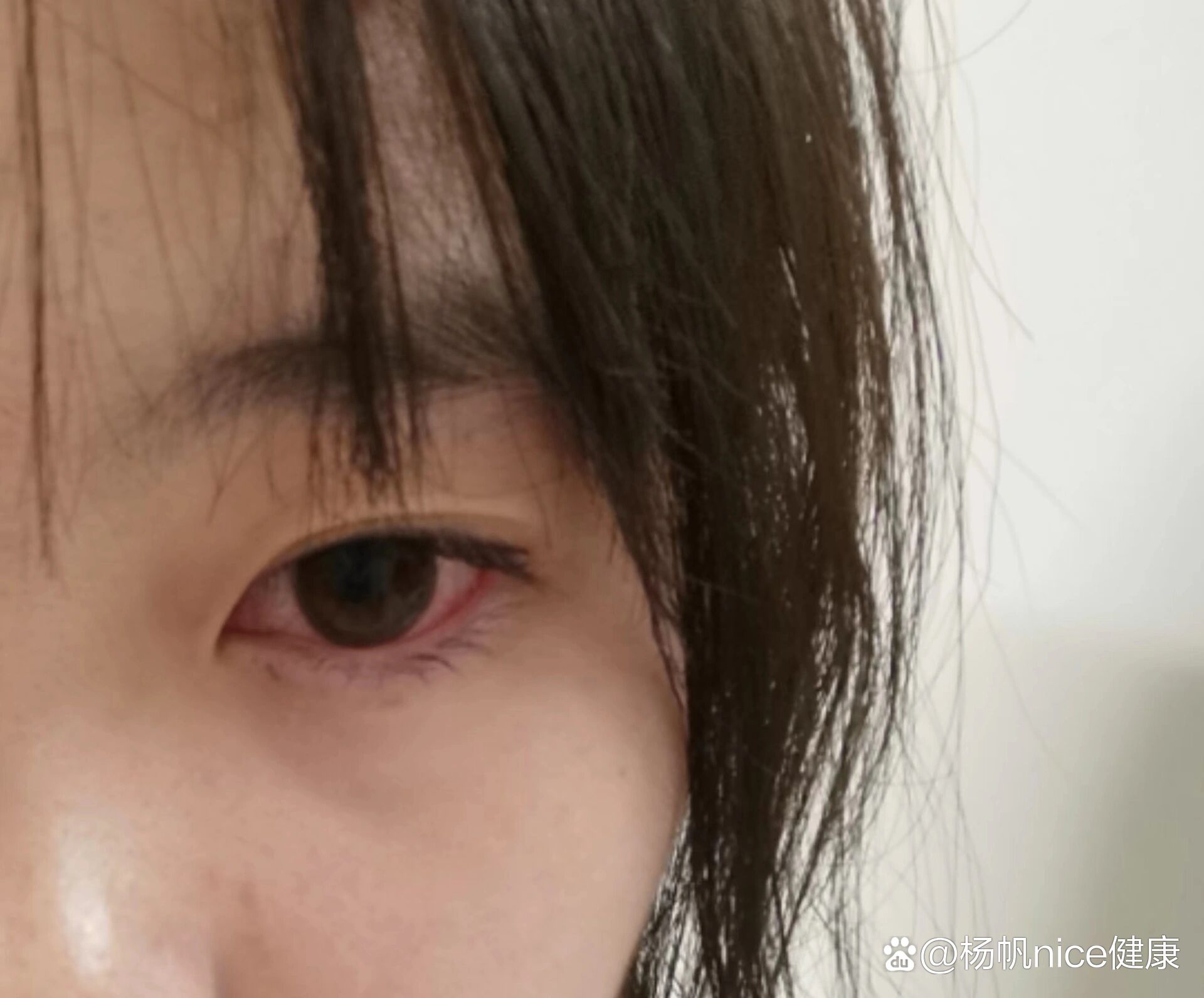 给大家来避个雷,因为有活动,所以就戴了美瞳大概五个小时