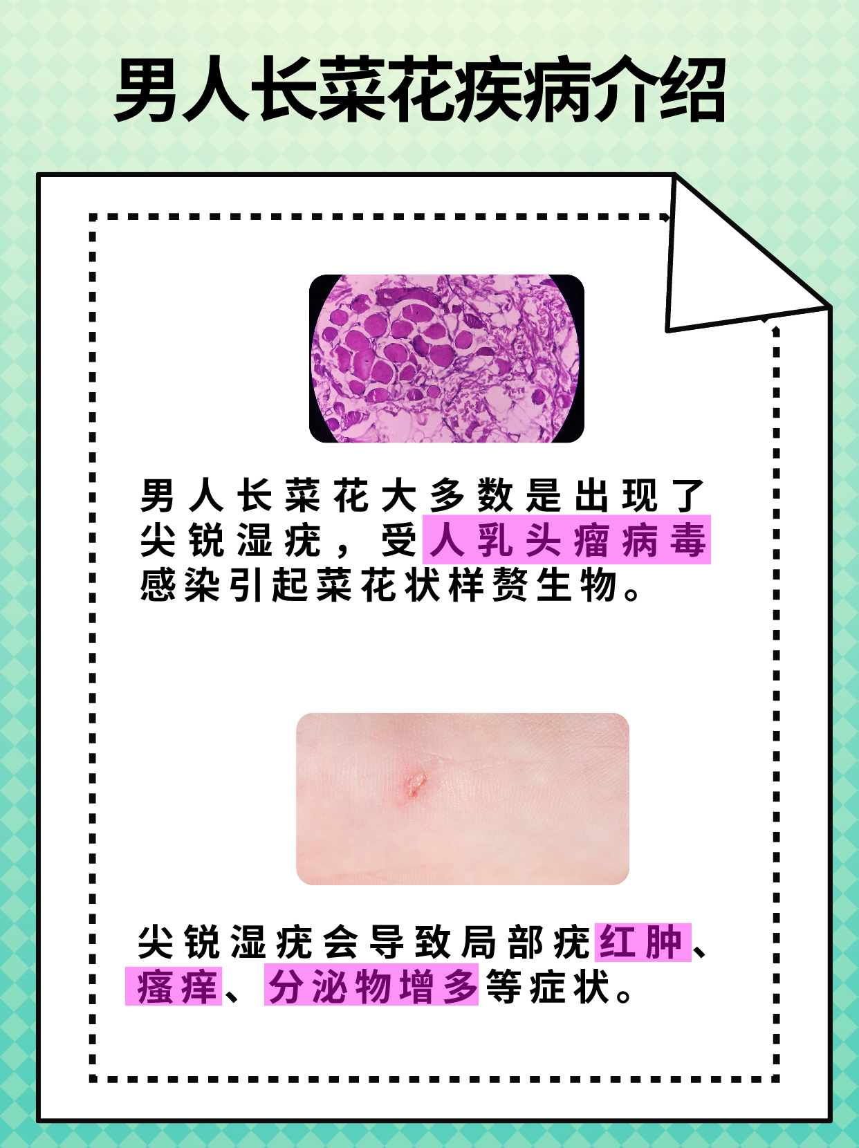 男人长菜花病答案揭晓