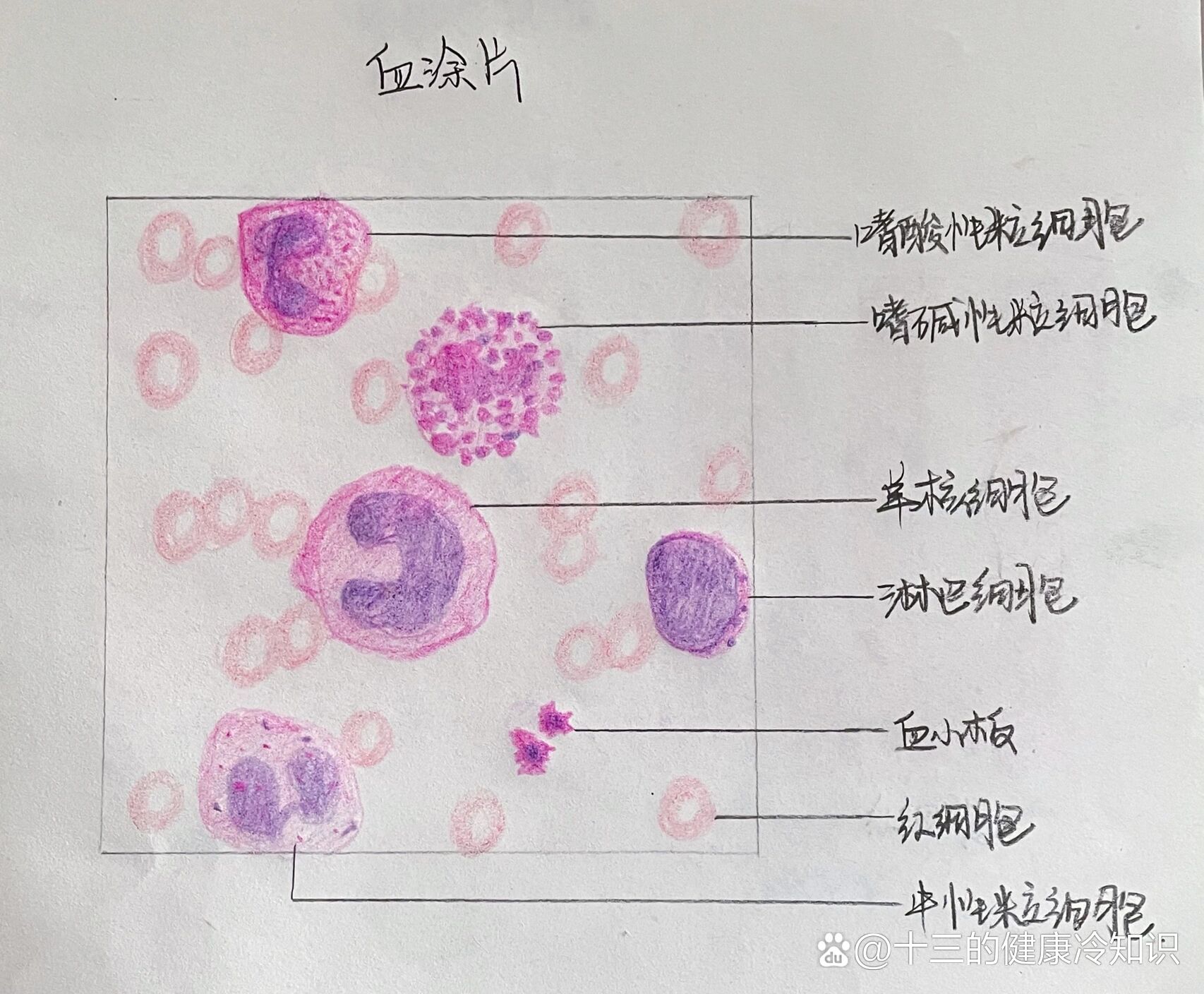 血涂片制作图片