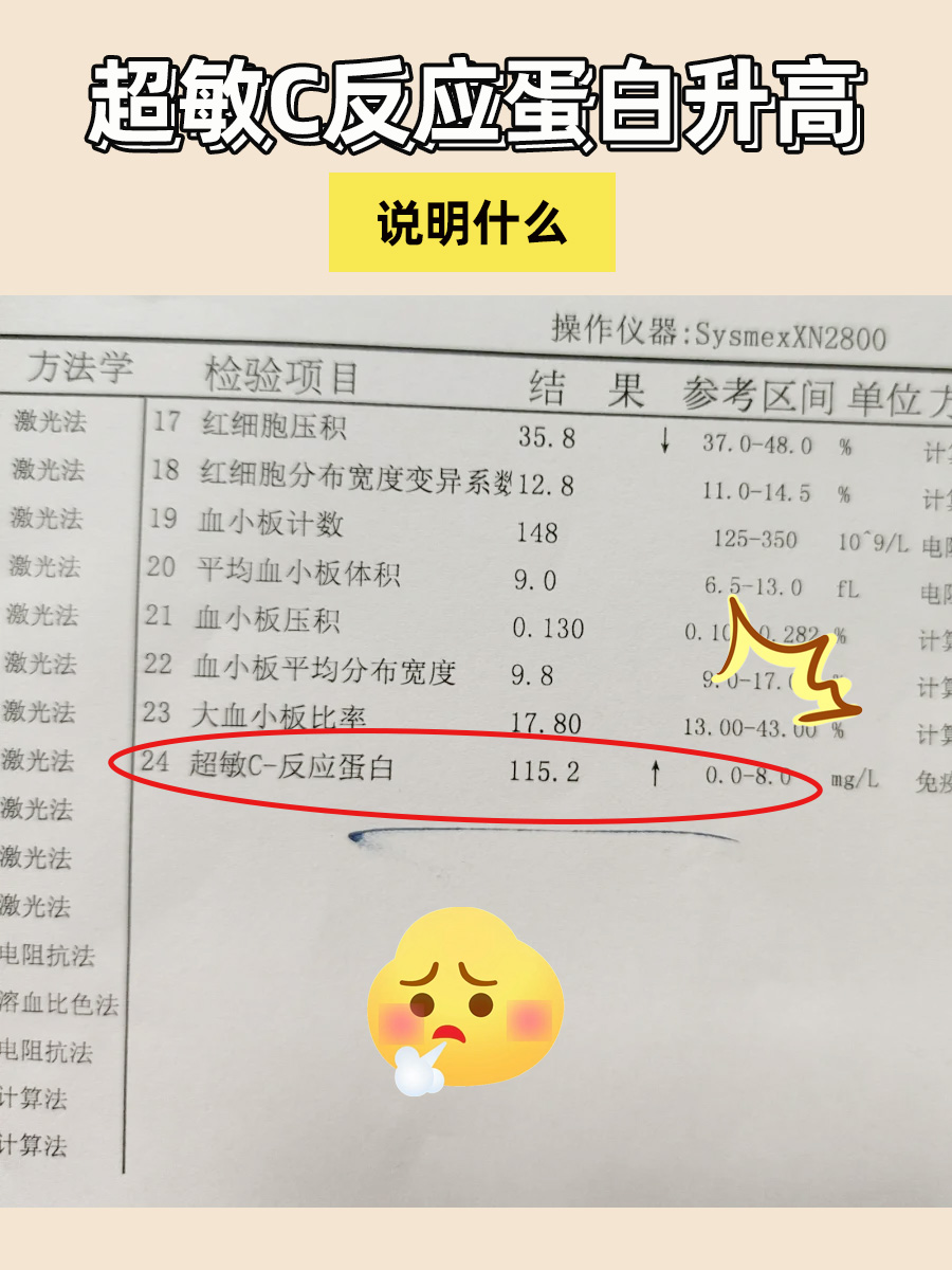 超敏c反应蛋白升高,健康需留心