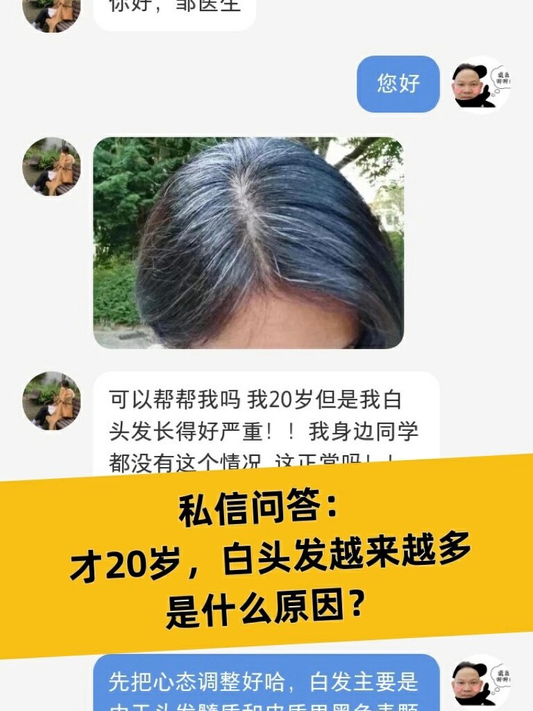 白头发越来越多怎么办?