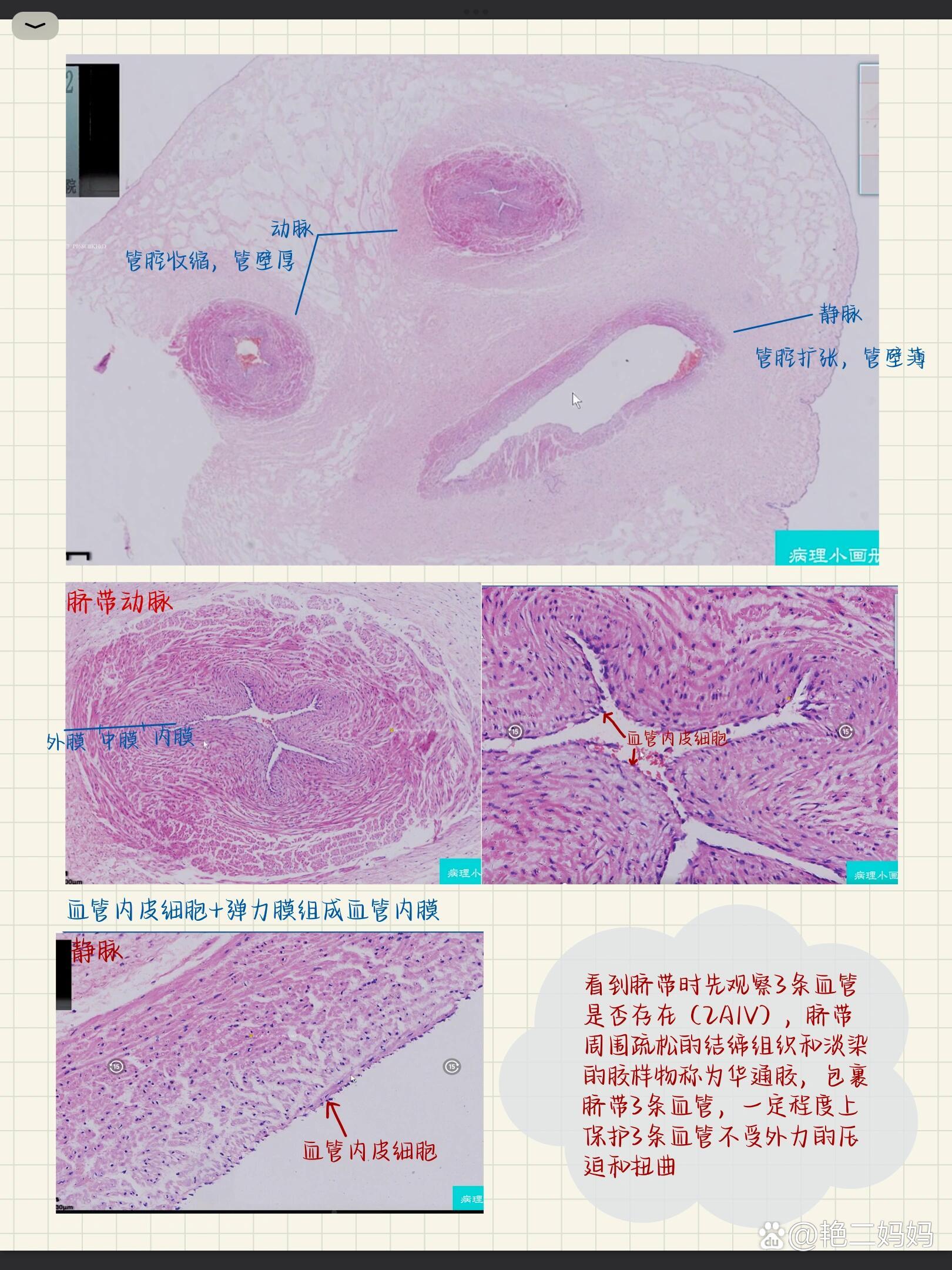 病理笔记|镜下正常组织结构(胎盘)