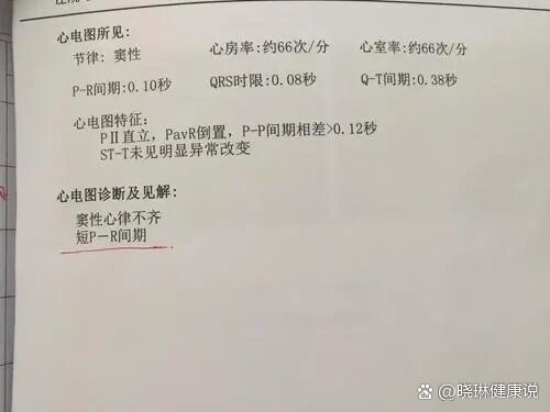 窦性心律不齐是心脏病吗?