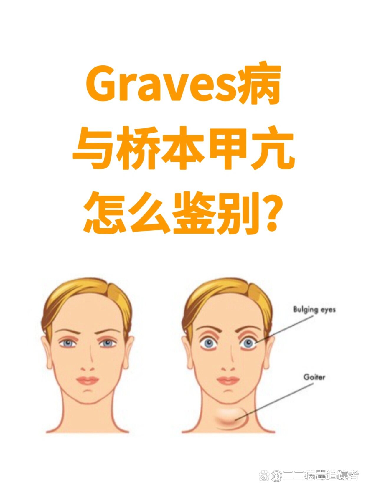 如何判断graves病?