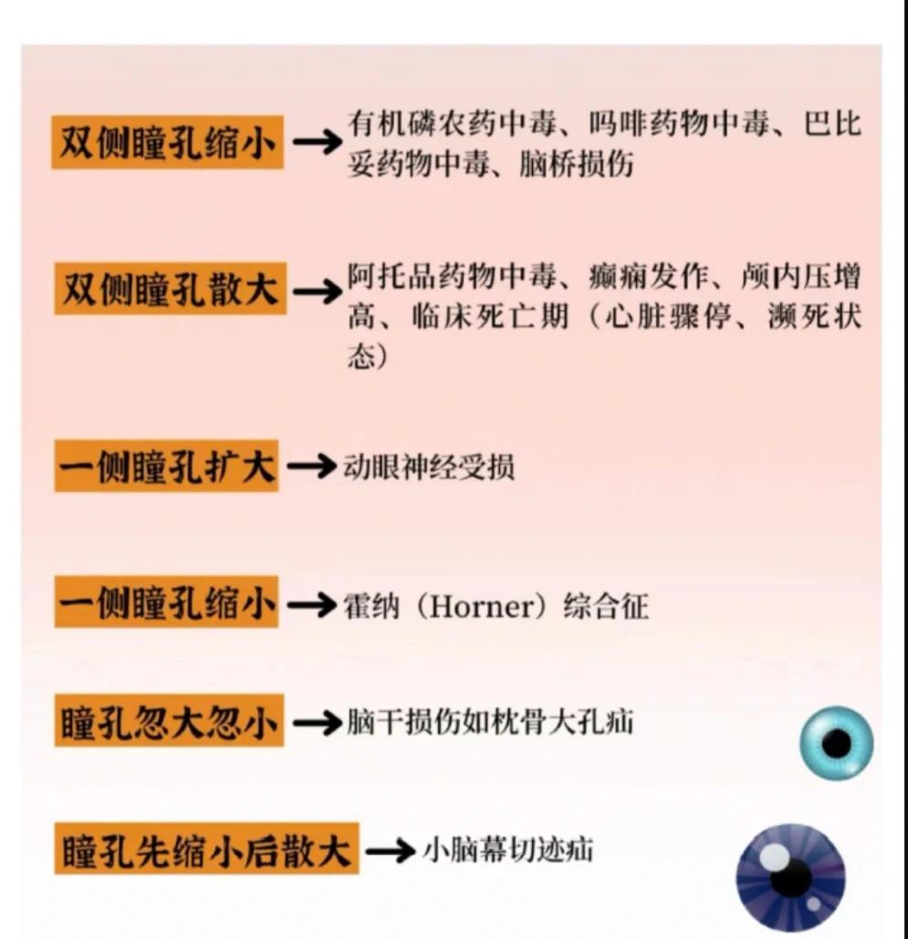 瞳孔变化速记指南🧐