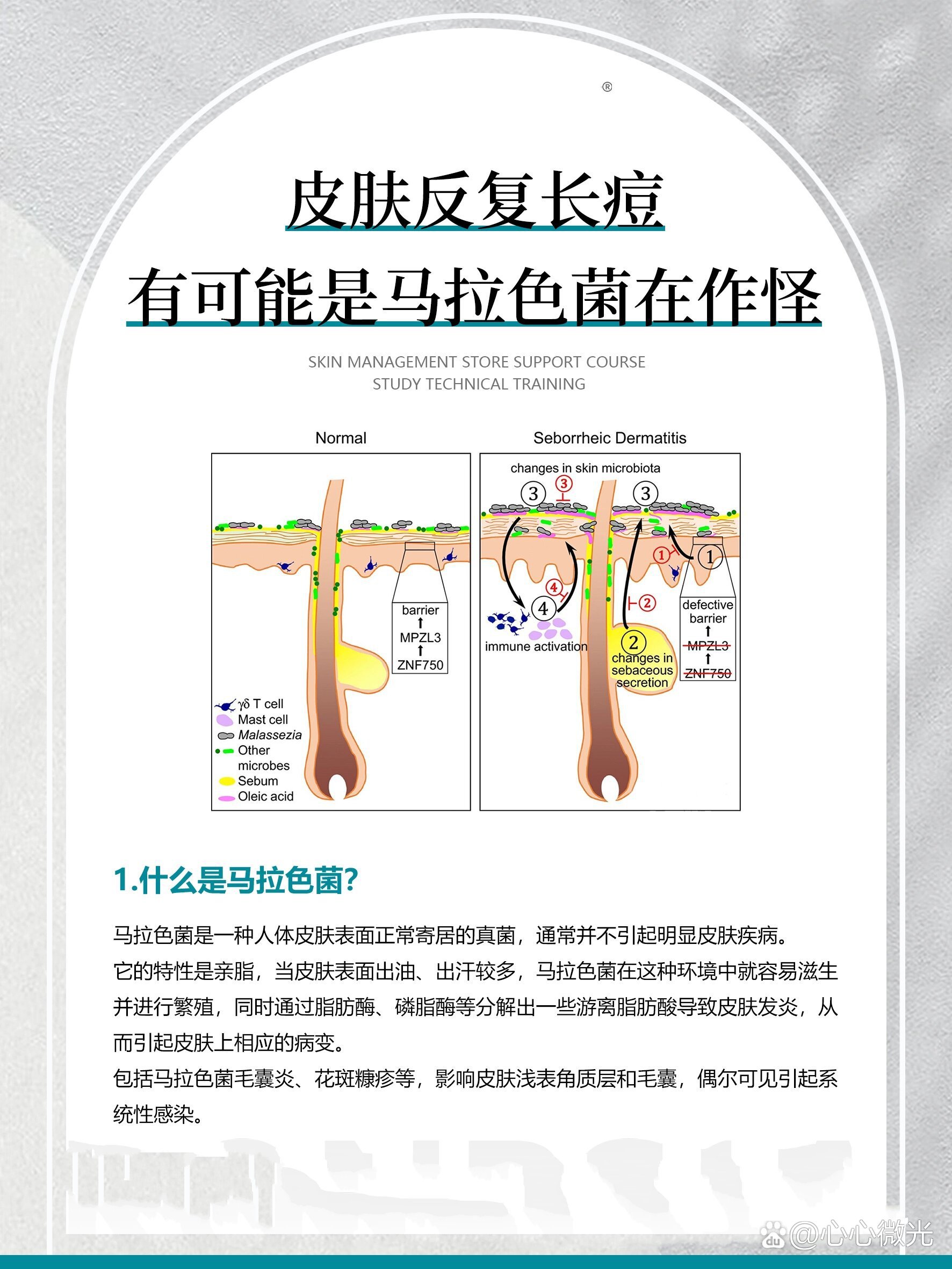 皮肤管理师必知马拉色菌是什么?