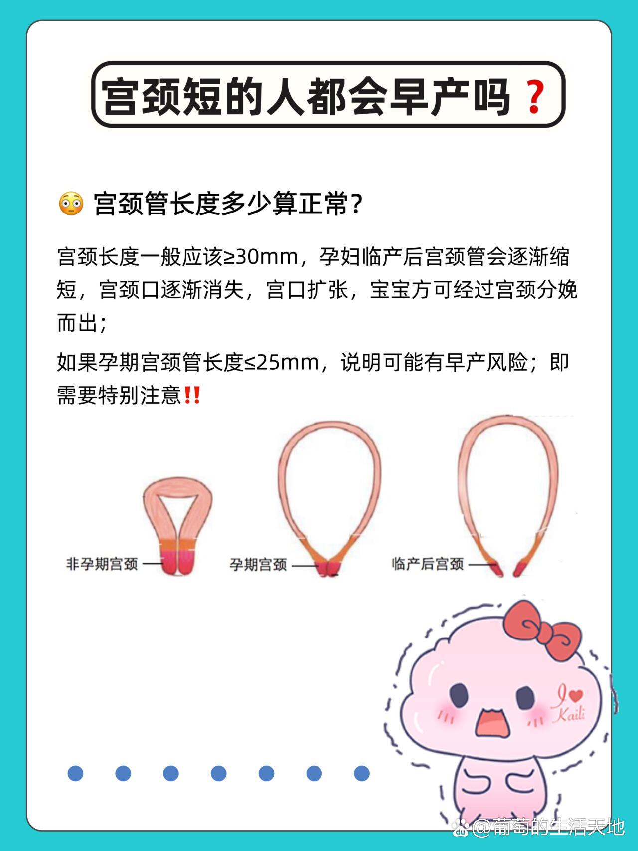 孕妇临产后宫颈管会逐渐缩短,宫颈口逐渐消失,宫口扩张,宝宝方可经过