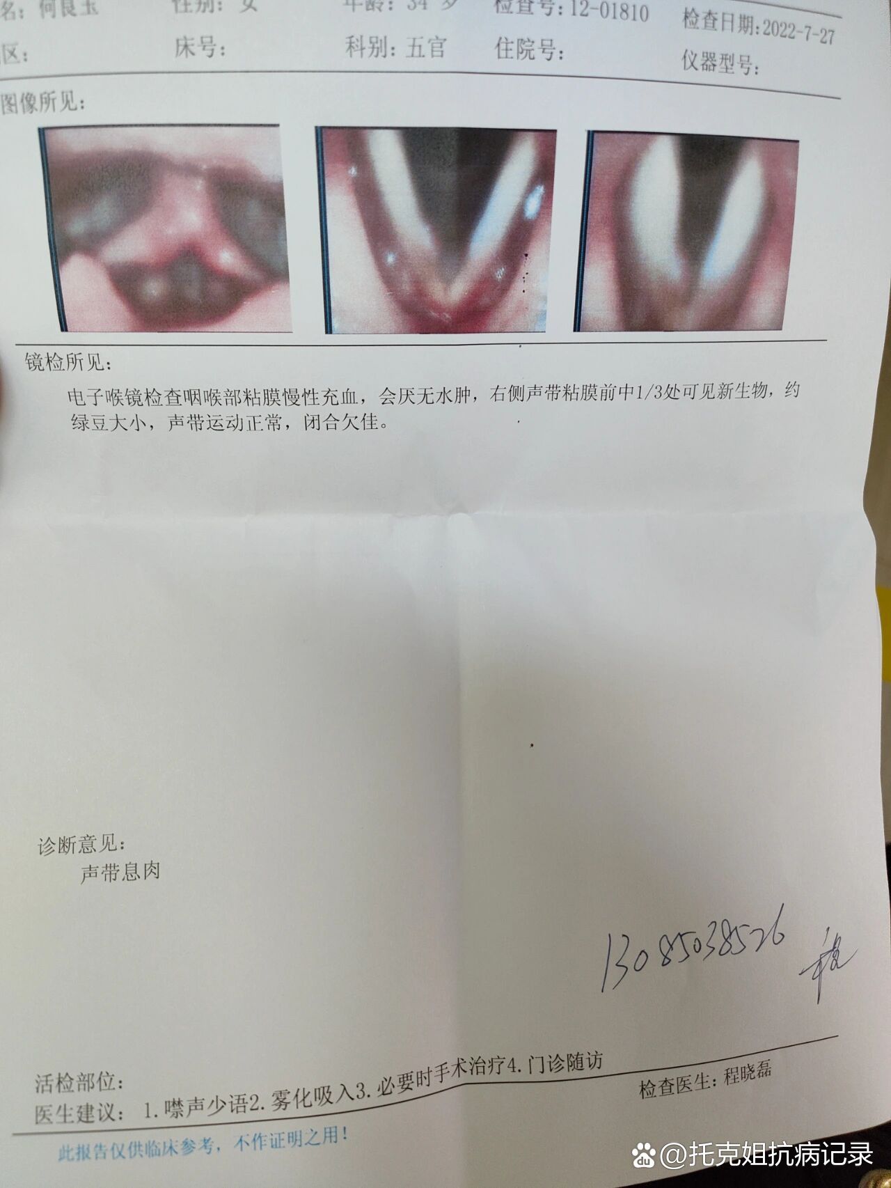 会厌息肉的症状图片图片