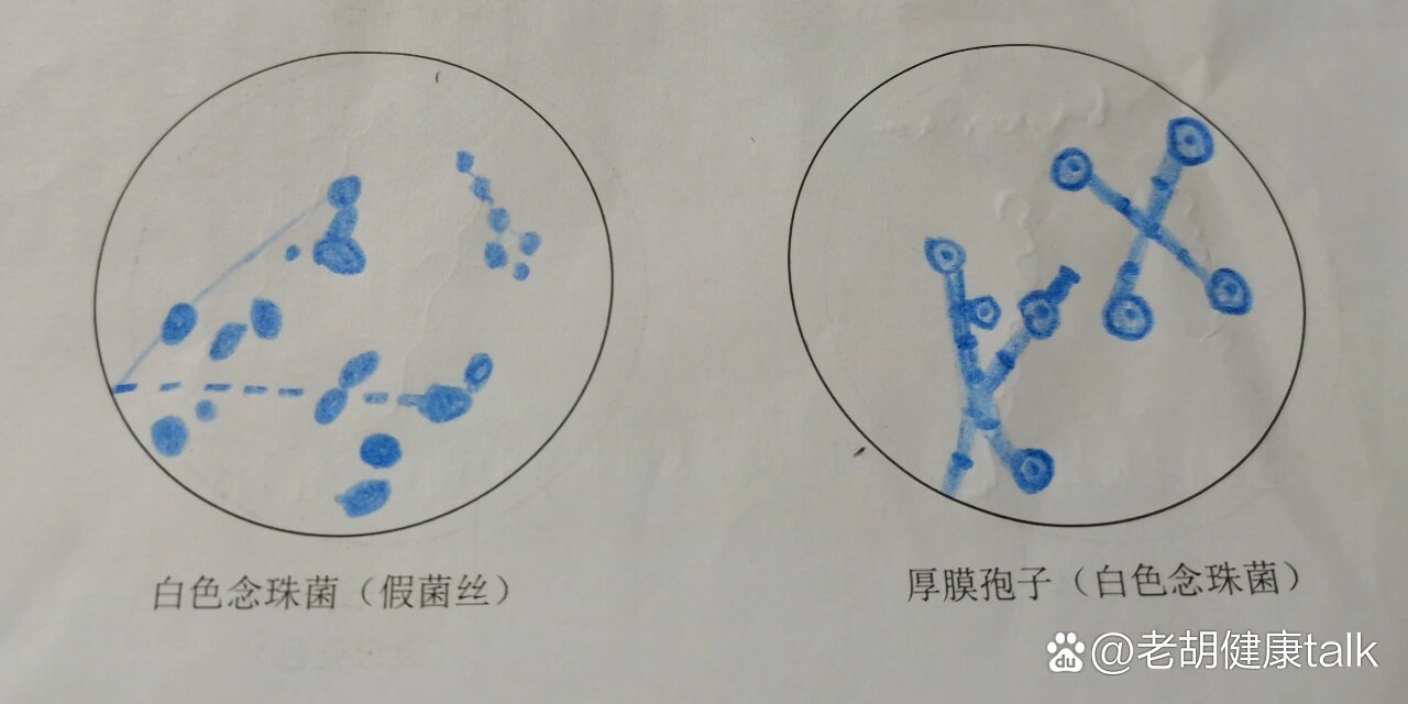 立克次体镜下图片图片