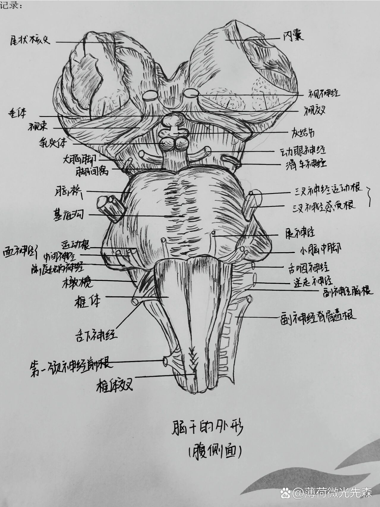 脑干腹侧面图片