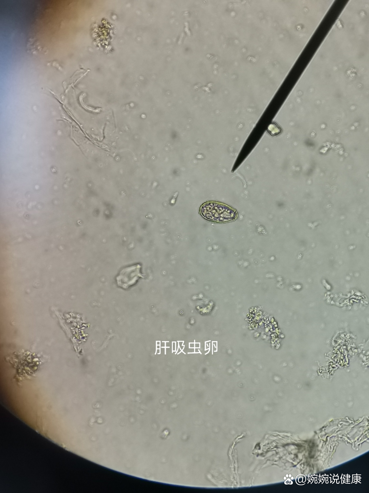 显微镜下各种寄生虫虫卵.