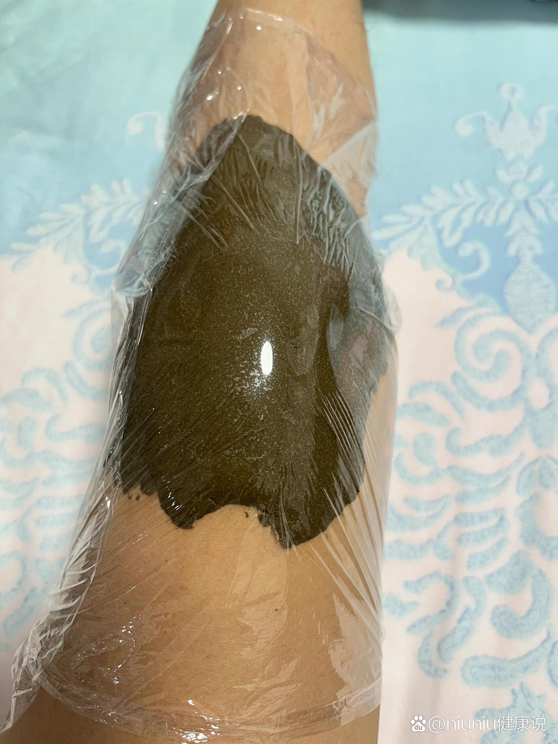  p>膝盖受寒 br>观望了一年的中药药敷终于在今天入手了,产后半年膝盖