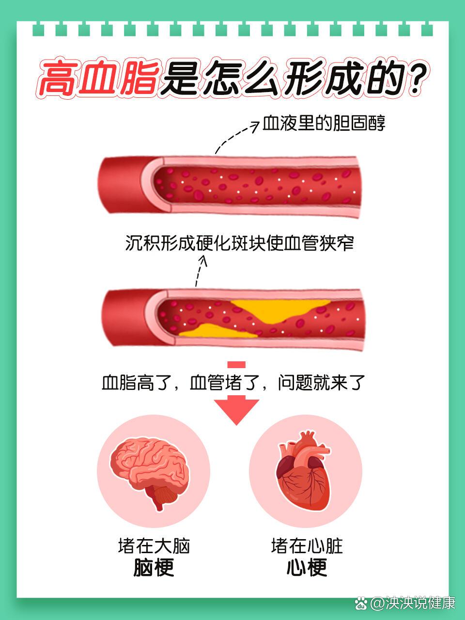 br 原本干净畅通的血液被血管中的垃圾堵住了