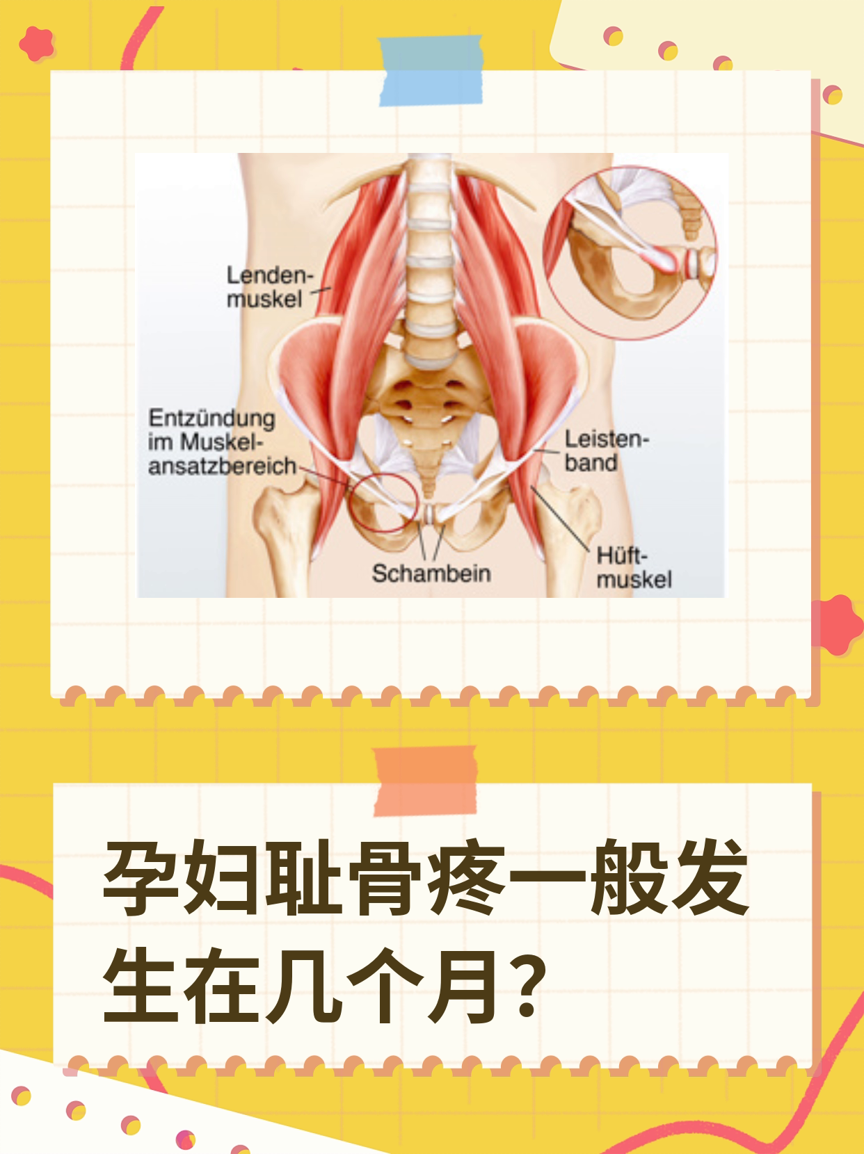 耻骨在哪个位置孕妇图片