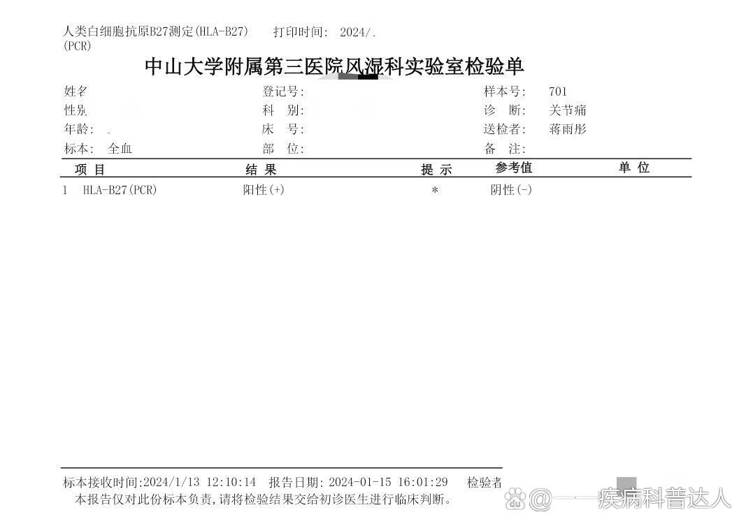 HLA-B27图片