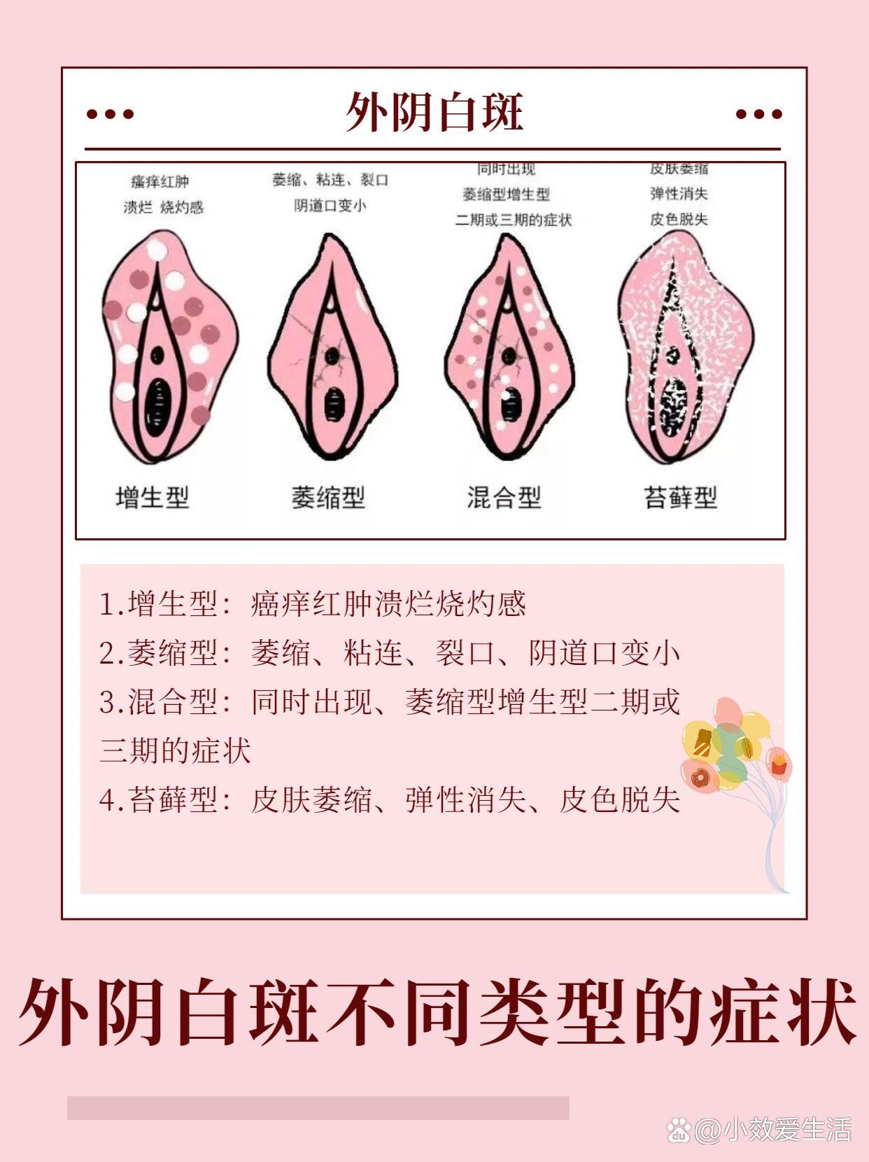 女生都该�住‼外阴白斑各种类型的症状❗