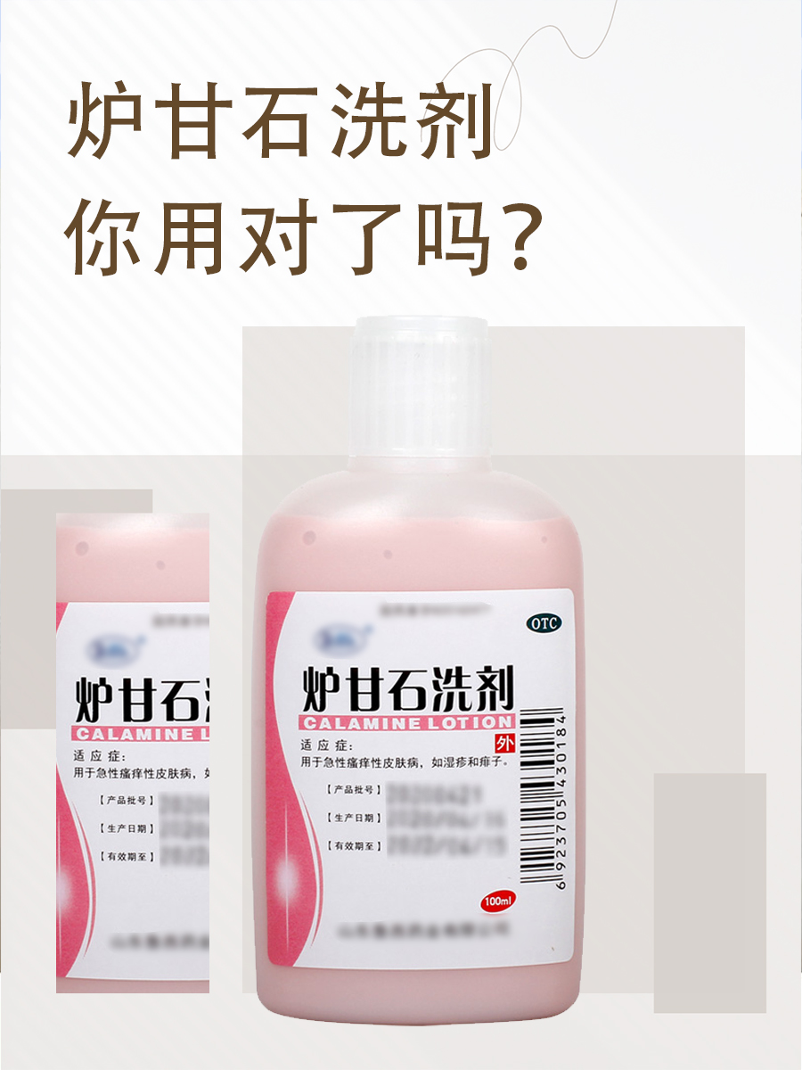 炉甘石洗剂,你用对了吗?