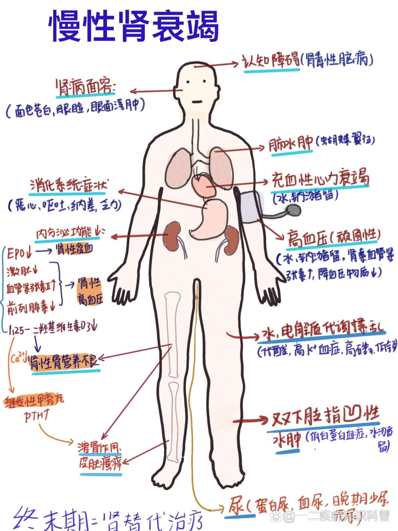 肾功能不全图片标准图片