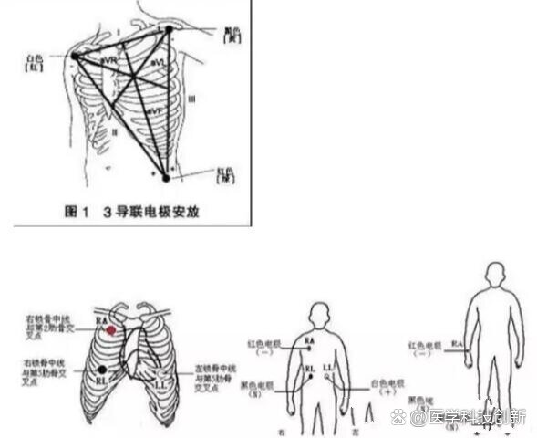 怎么判断是肋串珠图片