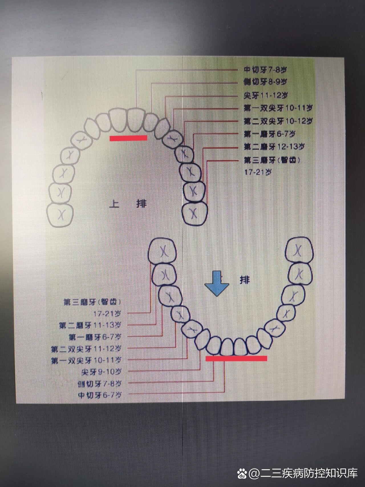 牙齿替换的顺序图片