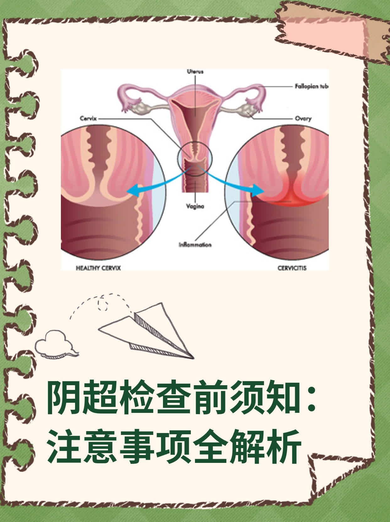 阴超痛吗图片