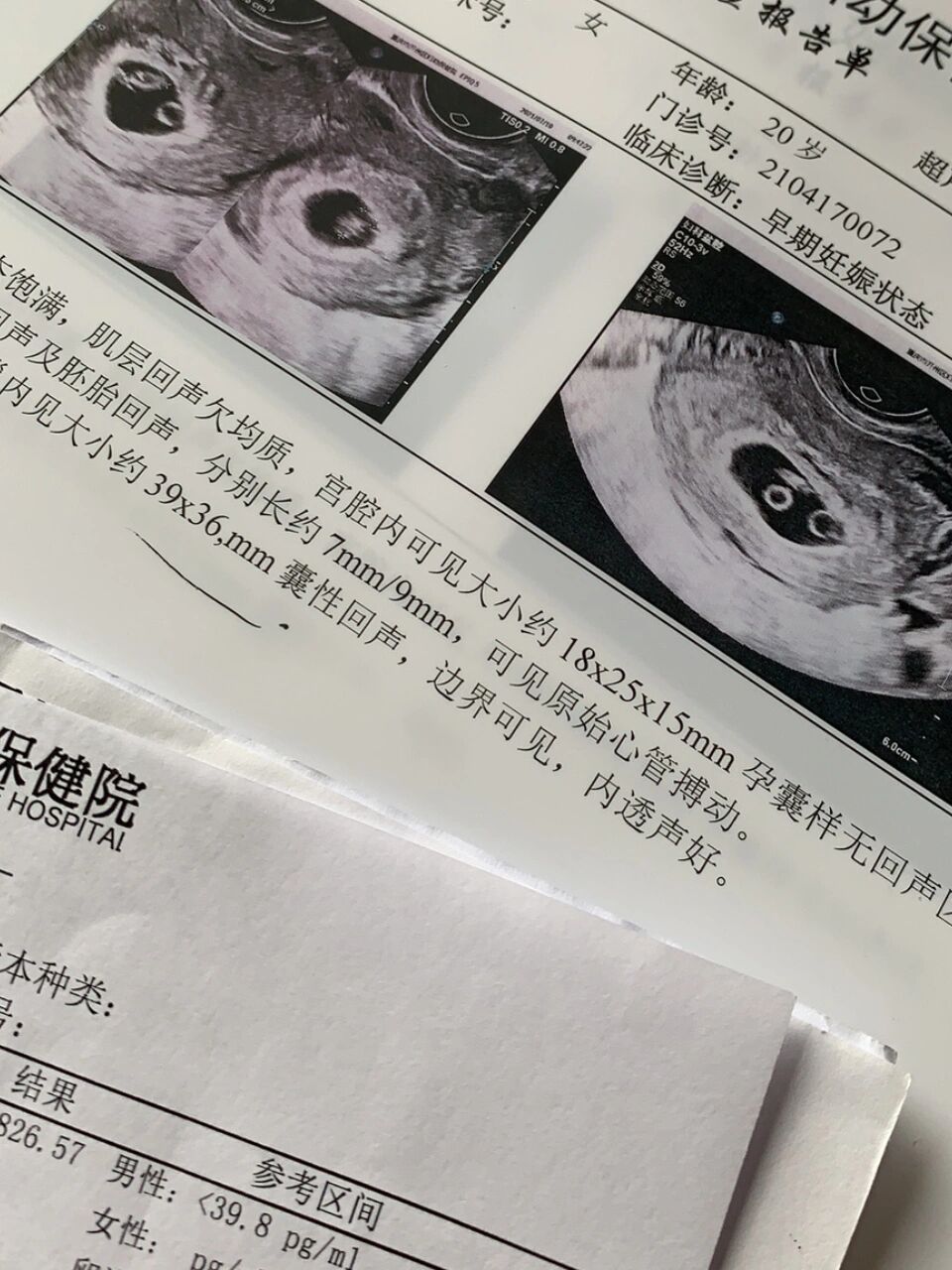 多卵巢多囊怀孕(卵巢多囊怀孕了对孩子有影响吗)