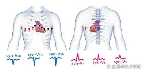 18导联心电图位置颜色图片