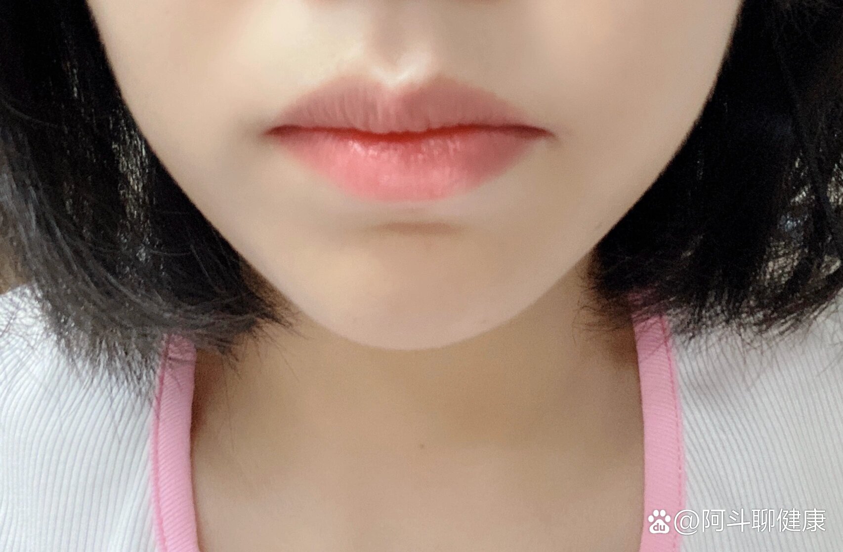 下巴上有条横沟