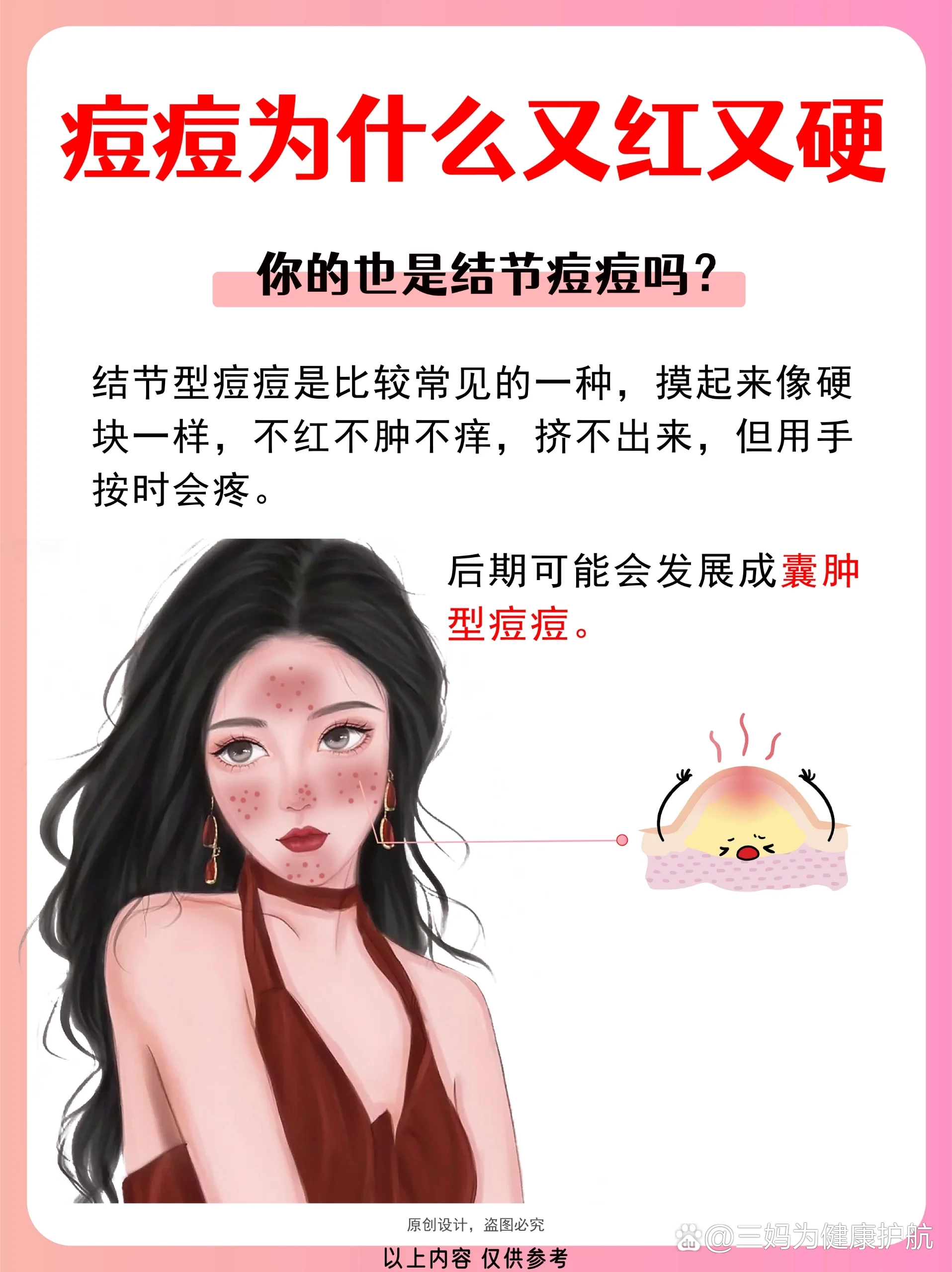 鼻翼一侧里面有硬块图图片