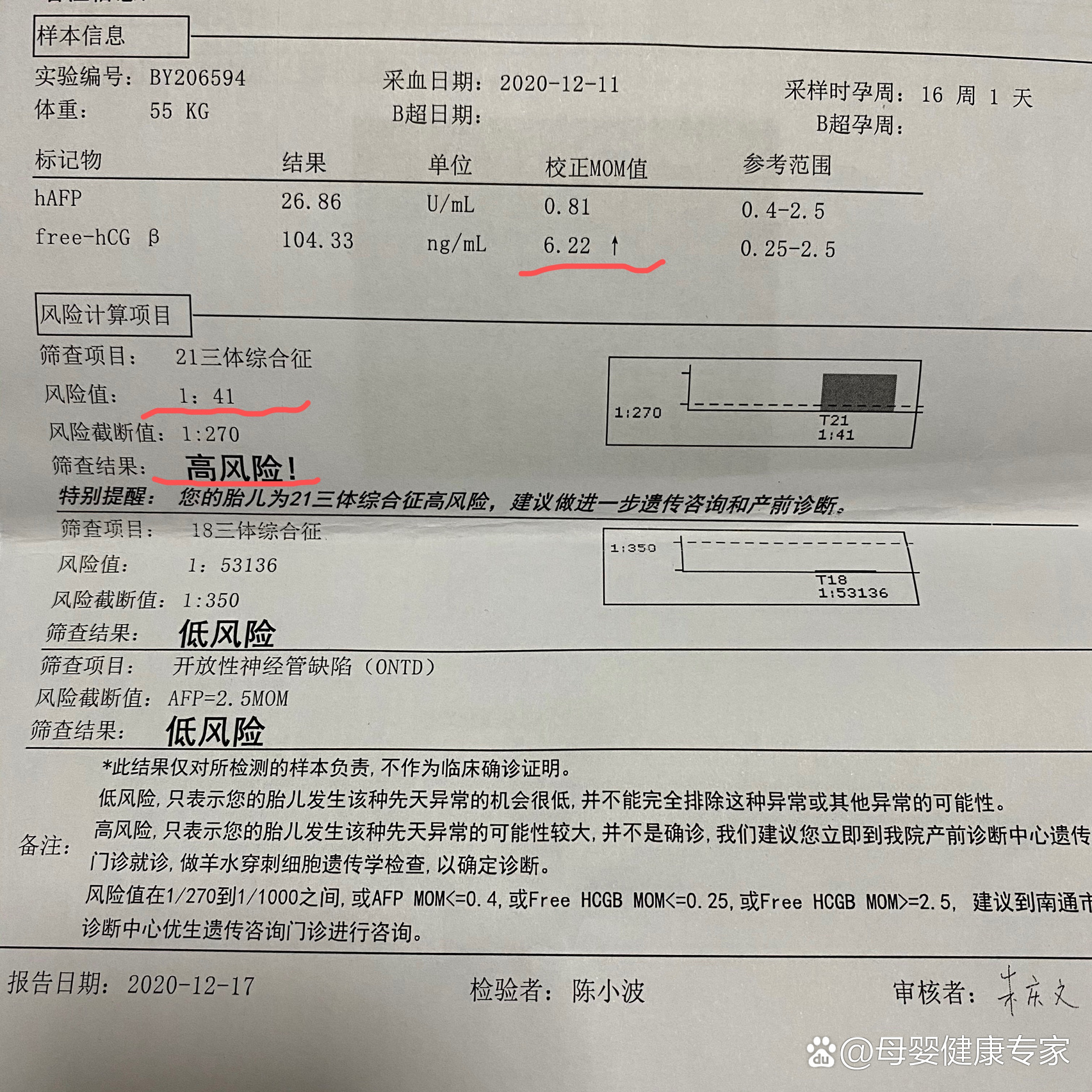 唐筛21三体高风险