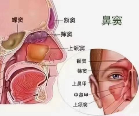 鼻粘膜水肿图片大全图片