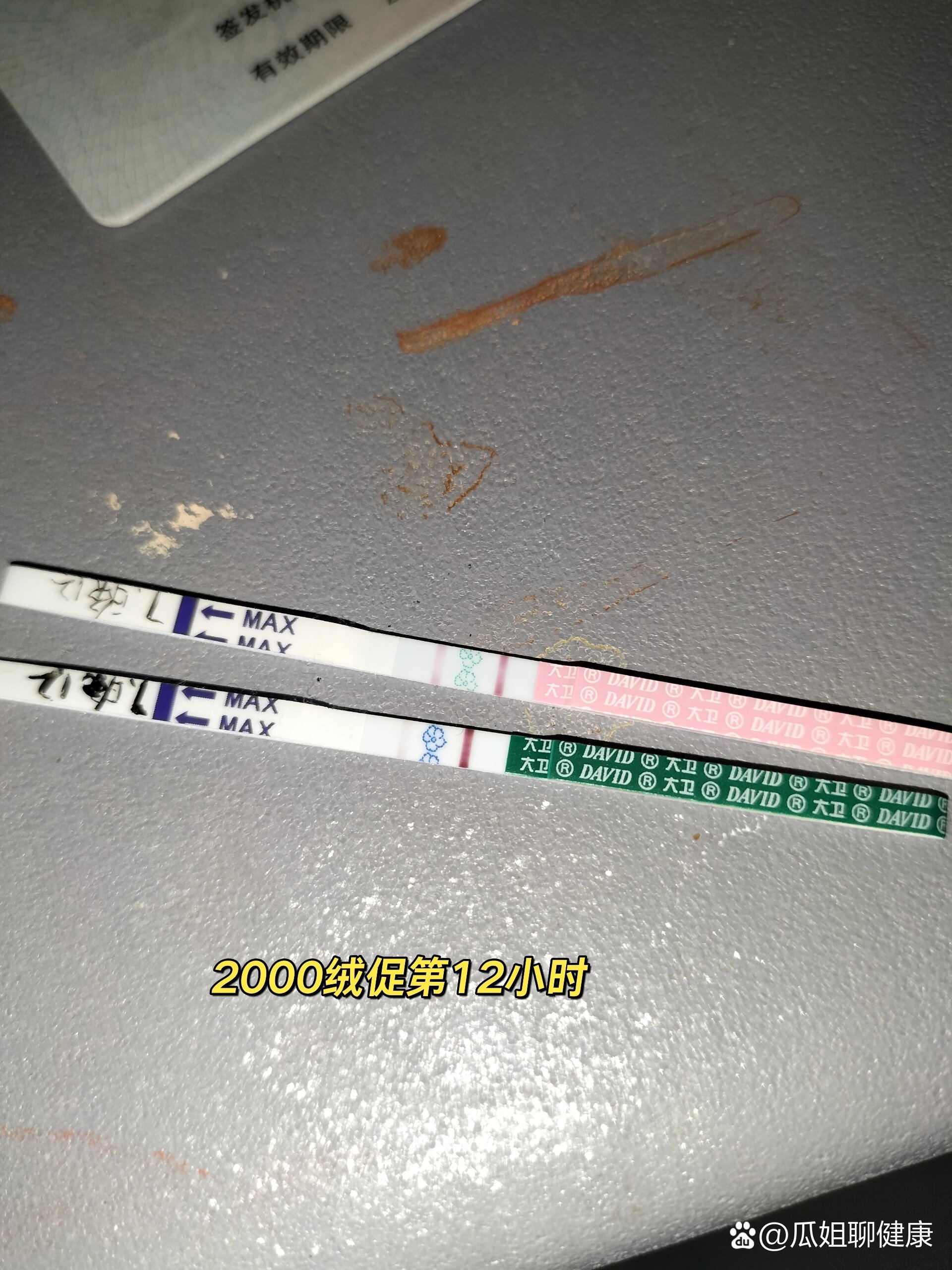 冻胚移植第七天的症状(冻胚移植第七天有什么感觉)
