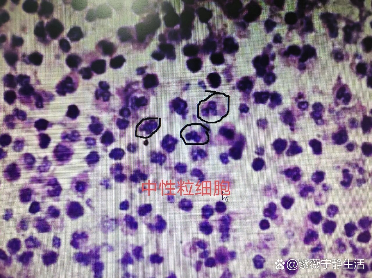 中性粒细胞光镜图图片