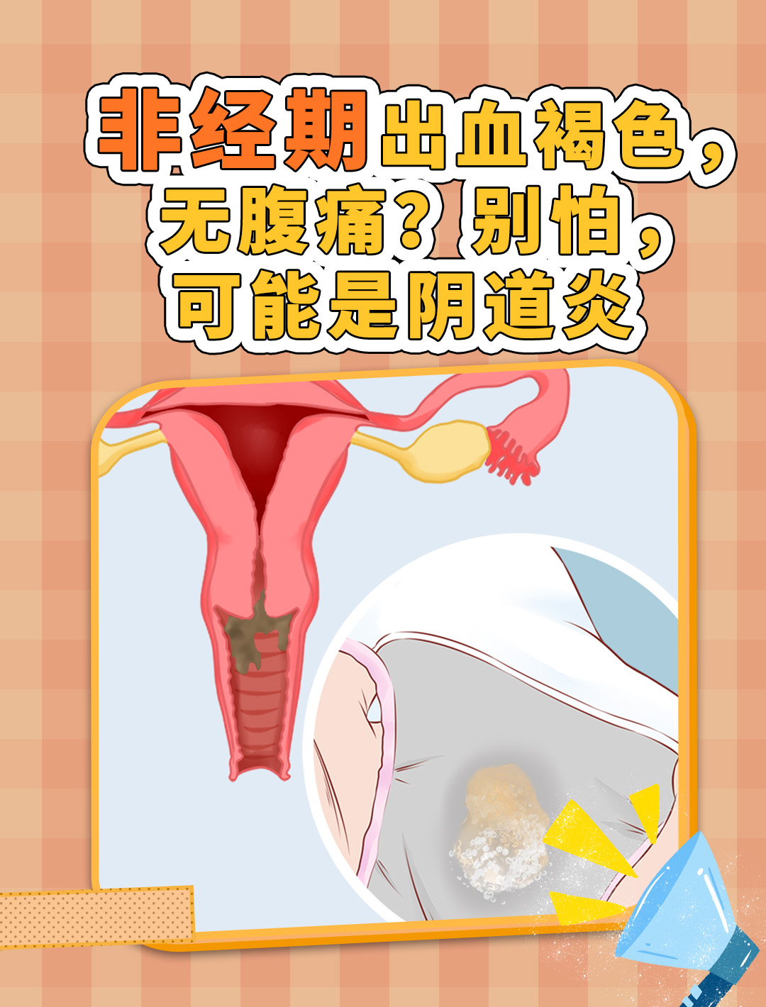 非经期出血褐色无腹痛?我的调理经验分享