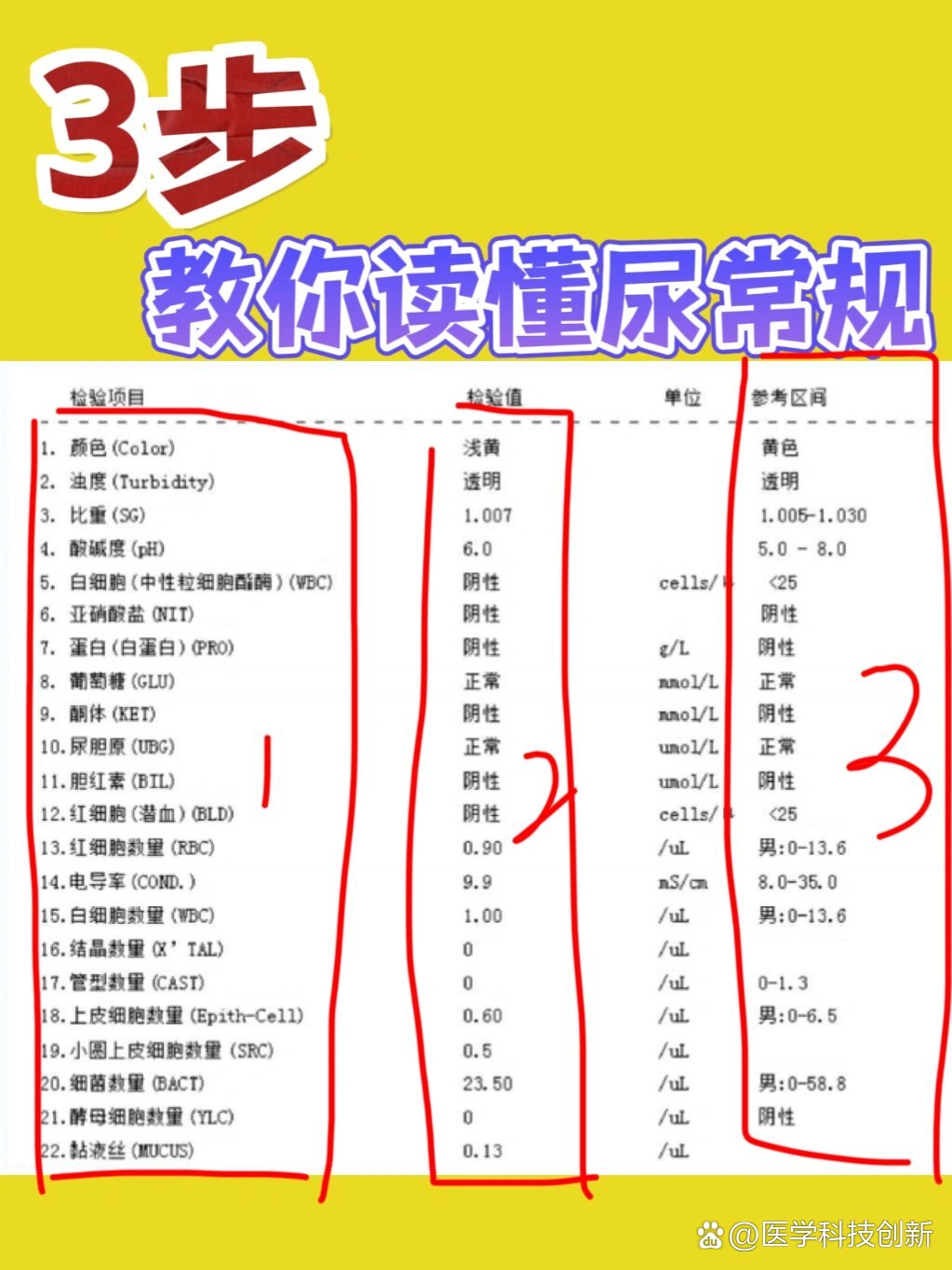 尿常规这些结果异常7215可能是肾有问题了75