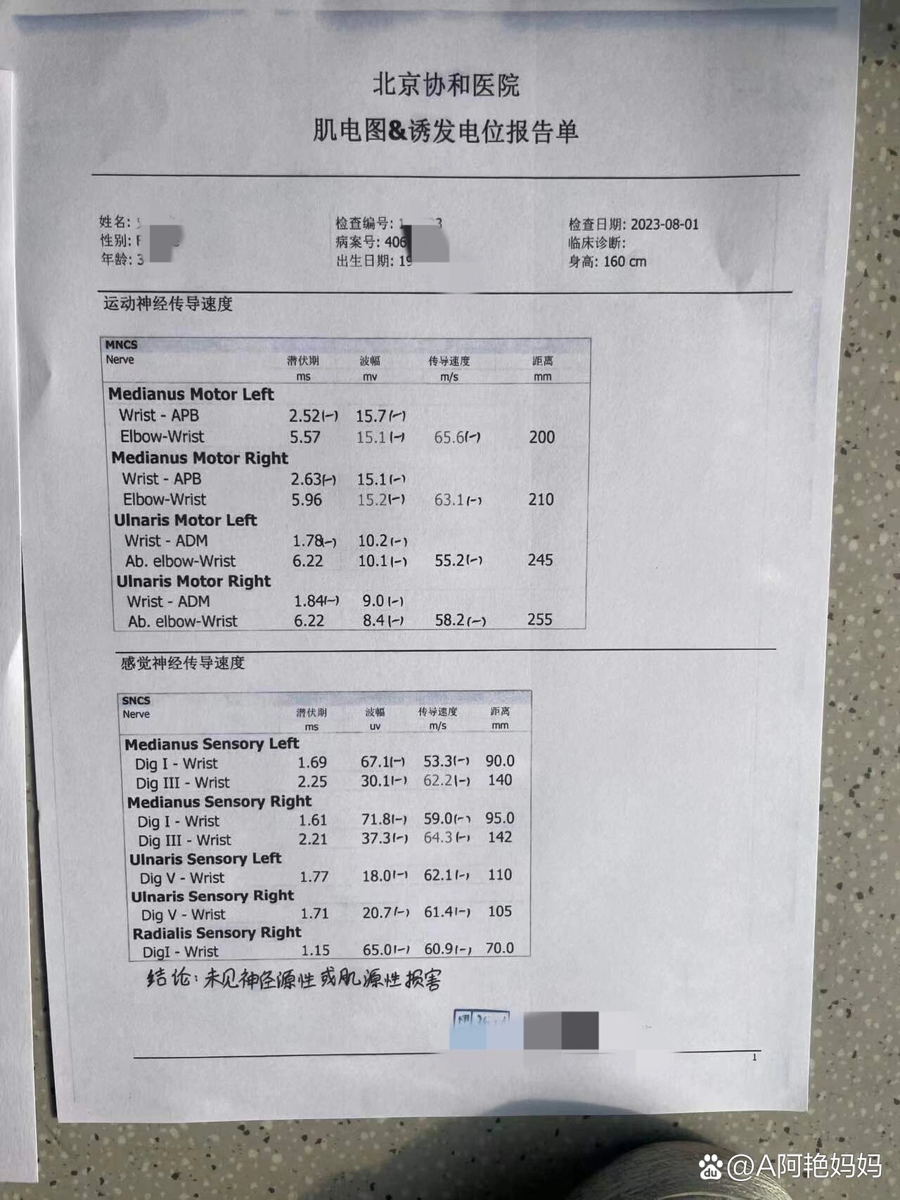 肌电图检查多少钱图片