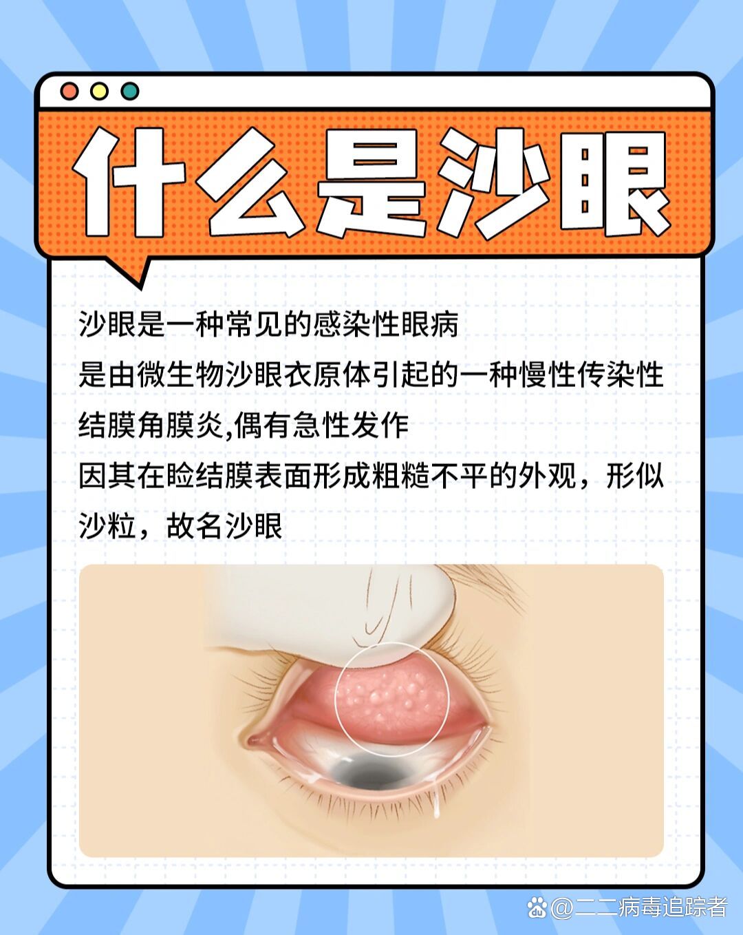 沙眼症状有哪些?