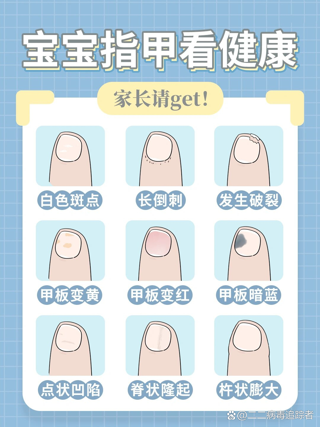 宝宝指甲看健康