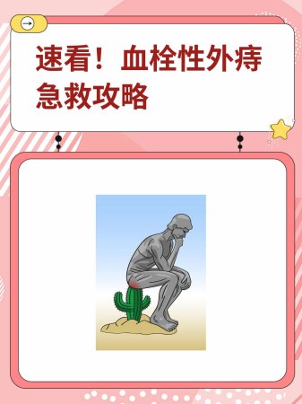 速看!血栓性外痔急救攻略