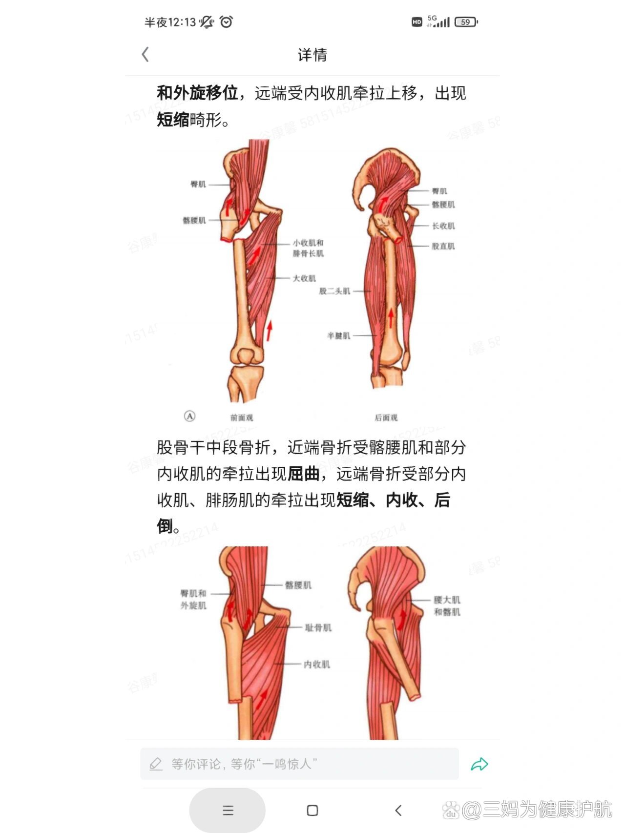 股骨内收肌结节图片