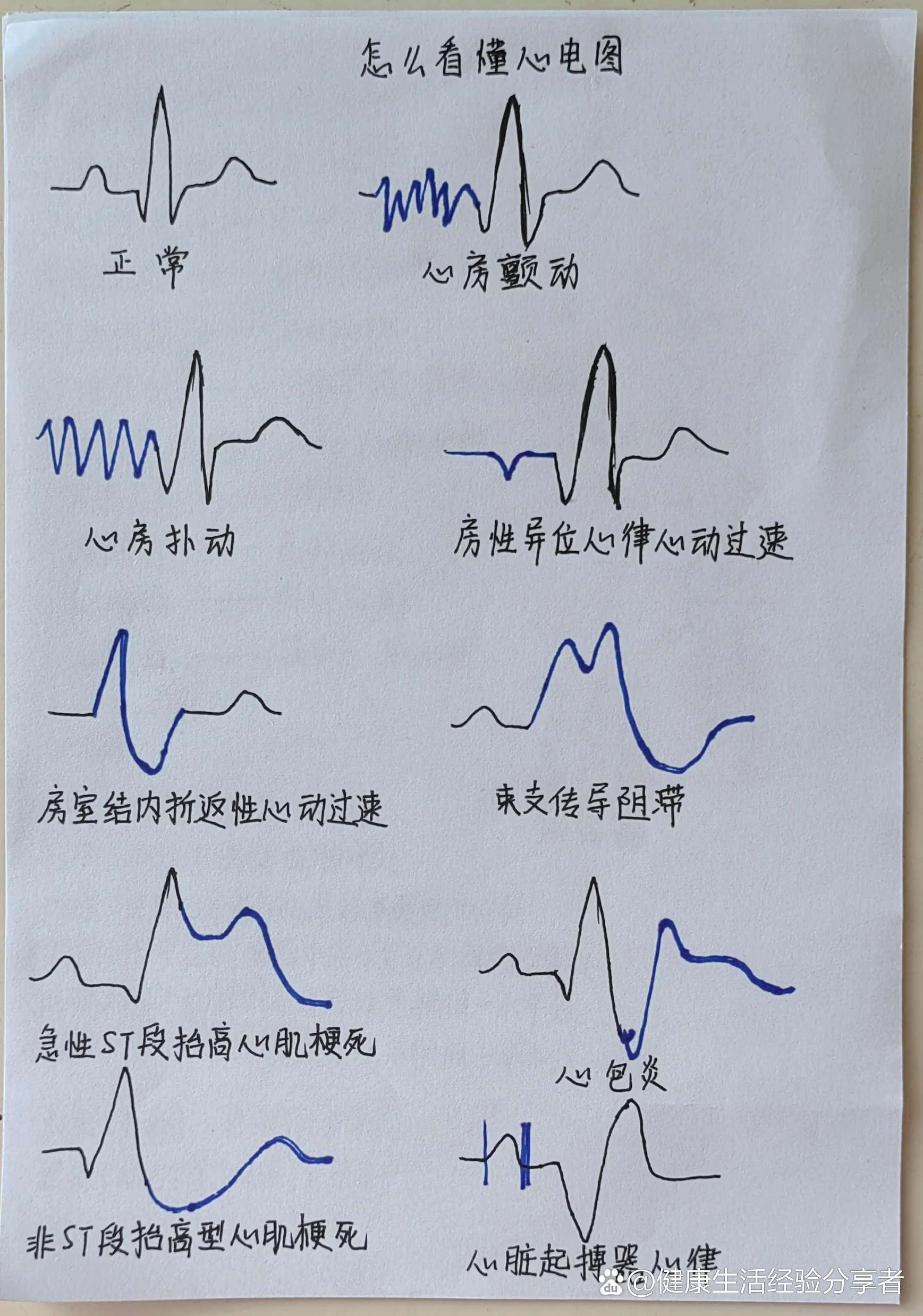 心电图图解