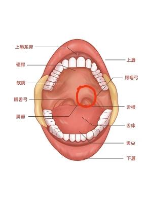 口腔上颚突然长出来一个很大的肿物